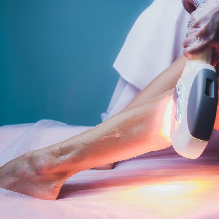 Laserowe Usuwanie Owłosienia-min
